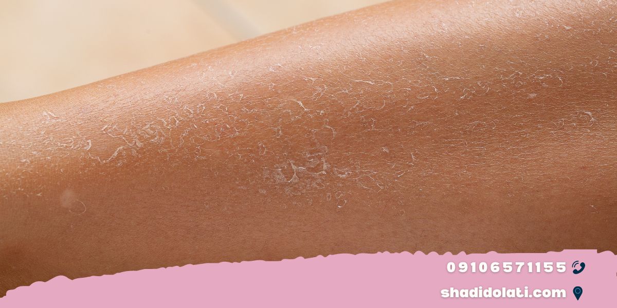 آیا باید نگران خشکی پوستمان باشیم؟